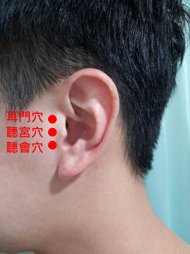 耳順之年耳不順   中醫治療減緩耳鳴症狀